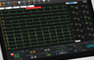 PC ECG