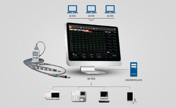 PC ECG